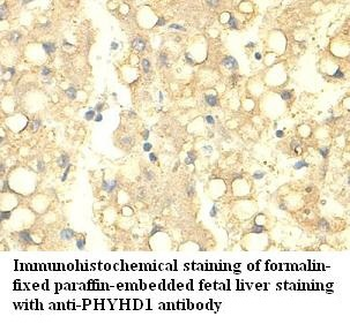 PHYHD1 Rabbit Polyclonal Antibody