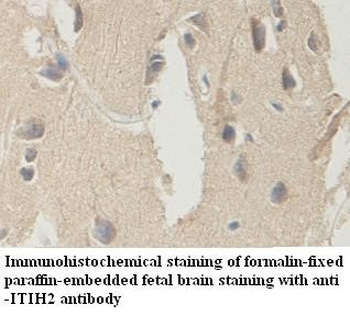 ITIH2 Rabbit Polyclonal Antibody