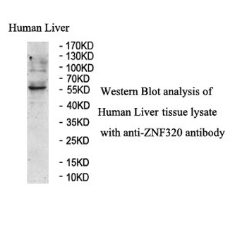 ZNF320 Rabbit Polyclonal Antibody