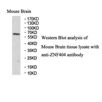 ZNF404 Rabbit Polyclonal Antibody