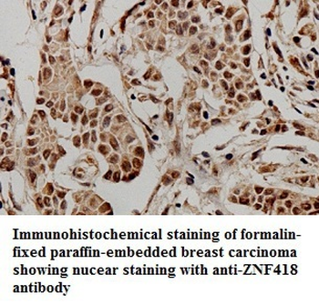ZNF418 Rabbit Polyclonal Antibody