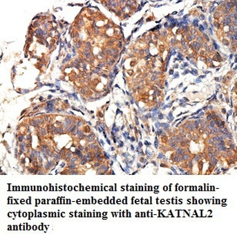 KATNAL2 Rabbit Polyclonal Antibody