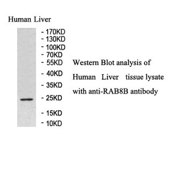 RAB8B Rabbit Polyclonal Antibody