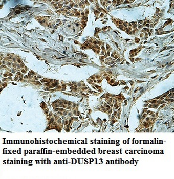 DUSP13 Rabbit Polyclonal Antibody