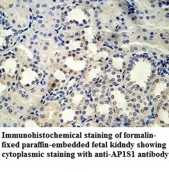 AP1S1 Rabbit Polyclonal Antibody