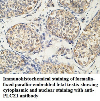 PLCZ1 Rabbit Polyclonal Antibody