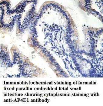 AP4E1 Rabbit Polyclonal Antibody