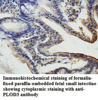 PLOD3 Rabbit Polyclonal Antibody