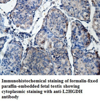 L2HGDH Rabbit Polyclonal Antibody