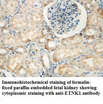 ETNK1 Rabbit Polyclonal Antibody