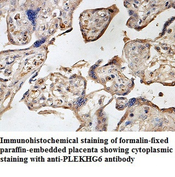 PLEKHG6 Rabbit Polyclonal Antibody
