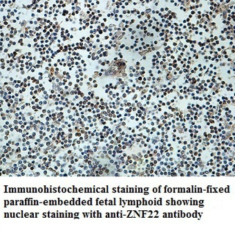 ZNF22 Rabbit Polyclonal Antibody