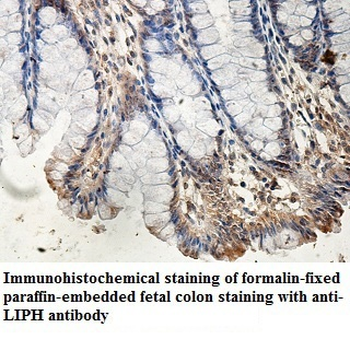 LIPH Rabbit Polyclonal Antibody
