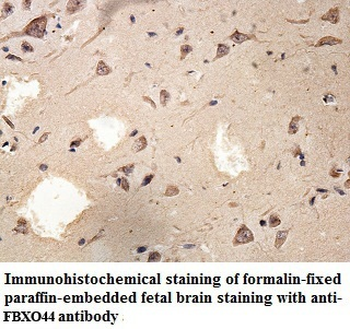 FBXO44 Rabbit Polyclonal Antibody