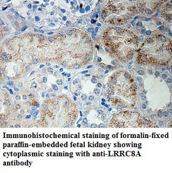 LRRC8A Rabbit Polyclonal Antibody