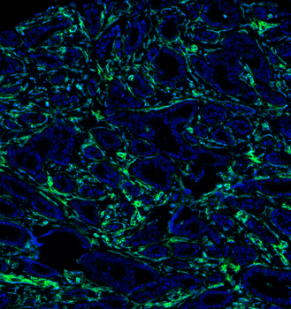 Goat anti-Vimentin Antibody