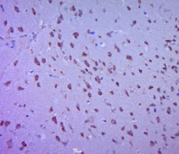 Creatine Kinase MM Rabbit Polyclonal Antibody