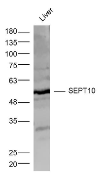 SEPT10 Rabbit Polyclonal Antibody