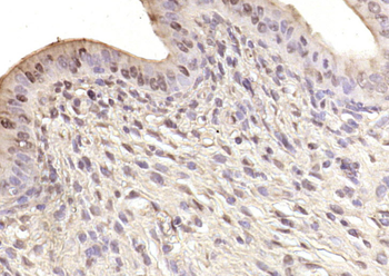 ARS2 Rabbit Polyclonal Antibody