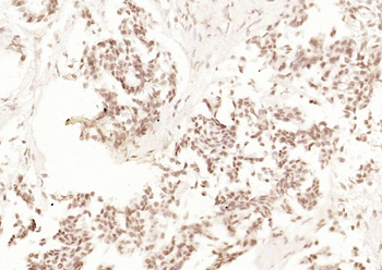 XPB Rabbit Polyclonal Antibody