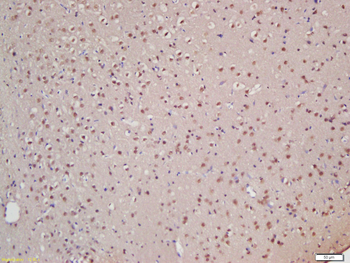 XPB Rabbit Polyclonal Antibody