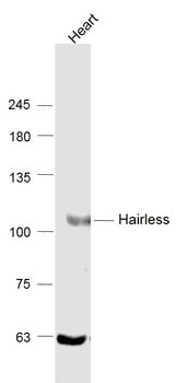 USP28 Rabbit Polyclonal Antibody