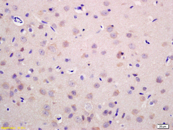 RAB21 Rabbit Polyclonal Antibody