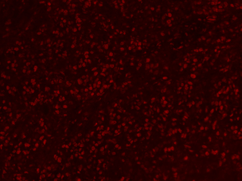 MYBL2 Rabbit Polyclonal Antibody