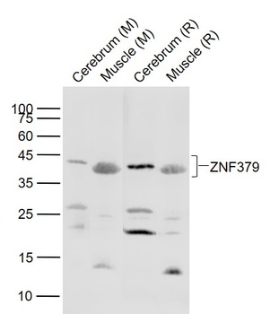 ZNF379 antibody