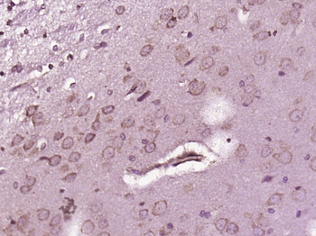 FUT8 Rabbit Polyclonal Antibody