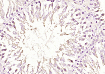 ABH8 Rabbit Polyclonal Antibody