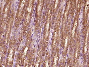 Vinculin Rabbit Polyclonal Antibody