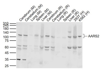 Alanyl-tRNA-synthetase 2 antibody