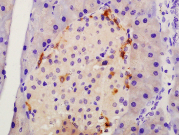 TMEM49 Rabbit Polyclonal Antibody
