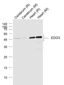 EDG3 Rabbit Polyclonal Antibody