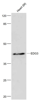 EDG3 Rabbit Polyclonal Antibody