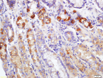 EDA2R Rabbit Polyclonal Antibody
