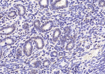 CENPT Rabbit Polyclonal Antibody