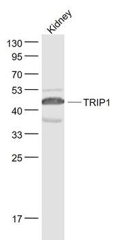 TRIP1 Rabbit Polyclonal Antibody