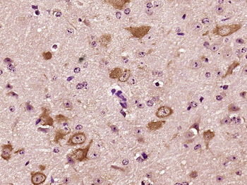 Nidogen Rabbit Polyclonal Antibody