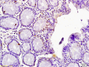 SPDYA Rabbit Polyclonal Antibody