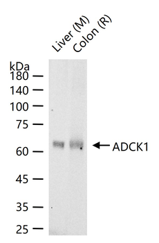 ADCK1 Rabbit Polyclonal Antibody
