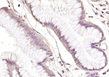 ANKRD11 Rabbit Polyclonal Antibody