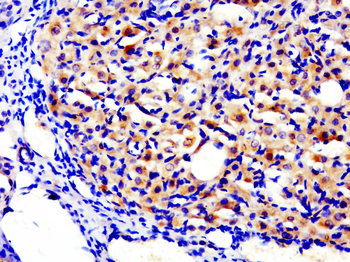 TG Rabbit Polyclonal Antibody