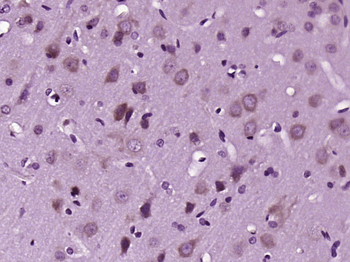 MARK2 Rabbit Polyclonal Antibody