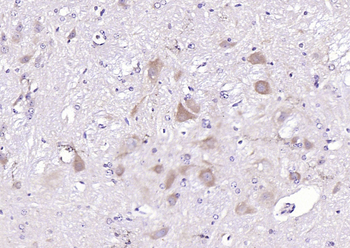NUAK2 Rabbit Polyclonal Antibody