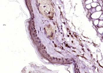 NUAK2 Rabbit Polyclonal Antibody