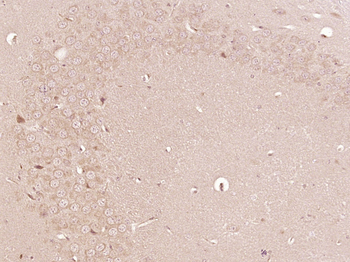 KLK8 Rabbit Polyclonal Antibody