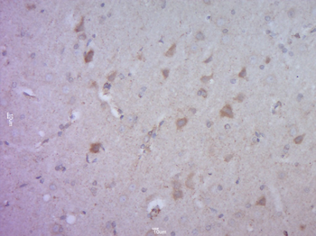 KLK8 Rabbit Polyclonal Antibody