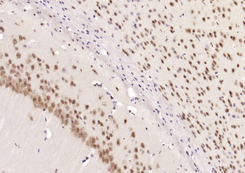 Alpha B Crystallin Rabbit Polyclonal Antibody